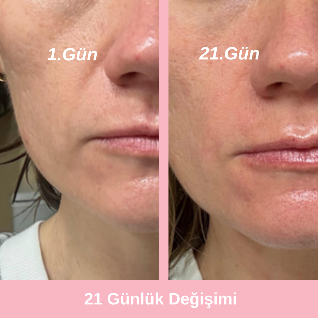 Canlıca Kore Retinal