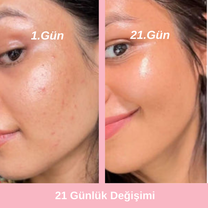 Canlıca Kore Retinal